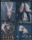 Infernal Restraints - Rusty Dagger & Summer ... Vorschau