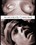 Internal Restraints - Anatomically Corrected Vorschau